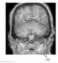 Fig. 01 - Interactive mesh editing