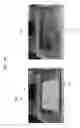 Fig. 20 - Wireless power transfer systems with shield openings