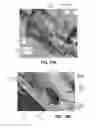 Fig. 29 - Pad raising mechanism in wafer positioning pedestal for semiconductor processing