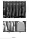 Fig. 04 - Device and method of manufacturing high aspect ratio structures