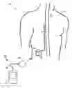 Fig. 01 - Sensing temperature within medical devices