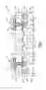 Fig. 02 - Electronic devices formed in a cavity between substrates and including a via