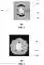 Fig. 03 - Method and apparatus for broadcast communication via guided waves