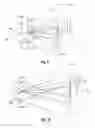 Fig. 06 - VARIABLE FOCAL LENGTH LENSES AND ILLUMINATORS ON TIME OF FLIGHT 3D SENSING SYSTEMS