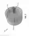 Fig. 06 - Systems, apparatus, and methods for hearing protection