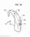 Fig. 03 - Transformable speech processor module for a hearing prosthesis