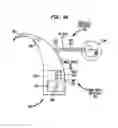Fig. 08 - Transformable speech processor module for a hearing prosthesis