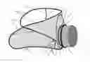 Fig. 01 - Coilable Aerodynamic Leaf Bagging Device Intended for Use with Power blower