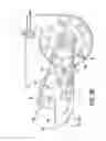 Fig. 28 - Multi-functional and modular tree removal and maintenance apparatus and related methods