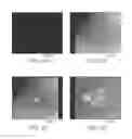 Fig. 06 - MOUSE MODEL OF RETINAL DEGENERATION