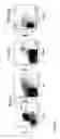 Fig. 03 - Transgenic Immunodeficient Mouse Expressing Human SIRP-alpha