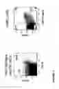 Fig. 04 - Transgenic Immunodeficient Mouse Expressing Human SIRP-alpha