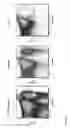 Fig. 09 - Transgenic Immunodeficient Mouse Expressing Human SIRP-alpha