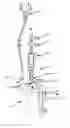Fig. 01 - Vent cutter and method for cutting loose tissue around a vent of poultry