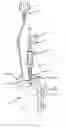 Fig. 03 - Vent cutter and method for cutting loose tissue around a vent of poultry