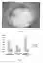Fig. 04 - Delivery system for food additives and its preparation