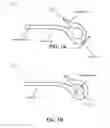 Fig. 02 - HAIR TIE EXTRACTION IMPLEMENT