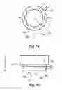 Fig. 02 - Ophthalmological patient interface