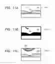 Fig. 12 - Ophthalmologic apparatus, and ophthalmologic imaging method