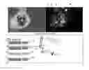 Fig. 01 - System and method for assessing perfusion in an anatomical structure