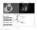 Fig. 08 - System and method for assessing perfusion in an anatomical structure