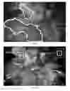 Fig. 09 - System and method for assessing perfusion in an anatomical structure