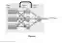 Fig. 07 - Device and method for non-invasive left ventricular end diastolic pressure (LVEDP) measurement