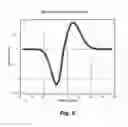 Fig. 06 - Detecting neuronal action potentials using a convolutive compound action potential model