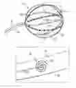 Fig. 01 - Catheter splines with embedded circuit elements