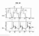 Fig. 31 - Method and apparatus for providing economical, portable deficit-adjusted adaptive assistance during movement phases of an impaired ankle
