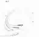 Fig. 02 - Ablation condition determination methods and systems