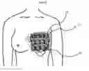 Fig. 07 - Device for detecting blood flow disturbance
