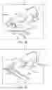 Fig. 09 - Systems and methods for planning and executing automated multi-axis motion in treatment