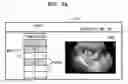 Fig. 06 - APPARATUS AND METHOD FOR PROCESSING ULTRASOUND IMAGE