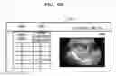 Fig. 07 - APPARATUS AND METHOD FOR PROCESSING ULTRASOUND IMAGE