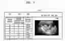 Fig. 08 - APPARATUS AND METHOD FOR PROCESSING ULTRASOUND IMAGE