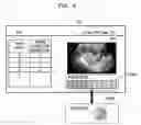 Fig. 09 - APPARATUS AND METHOD FOR PROCESSING ULTRASOUND IMAGE