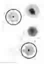 Fig. 15 - Ultrasonic CT Apparatus
