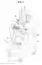 Fig. 02 - ULTRASONIC PROBE