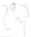 Fig. 02 - Cannula with proximally mounted camera