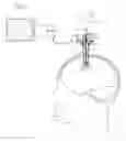 Fig. 06 - Cannula with proximally mounted camera