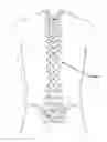 Fig. 01 - SUBLAMINAR SPINAL FIXATION SYSTEM AND METHOD OF USE