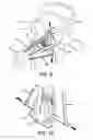 Fig. 08 - SUBLAMINAR SPINAL FIXATION SYSTEM AND METHOD OF USE