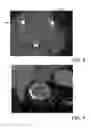 Fig. 07 - Evaluating prosthetic heart valve placement