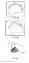 Fig. 10 - APPARATUS FOR GUIDING A MEDICAL TOOL
