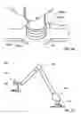 Fig. 07 - Methods, systems, and devices relating to force control surgical systems