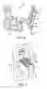 Fig. 04 - Surgical tool and robotic surgical system interfaces