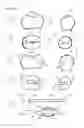 Fig. 04 - Direct dental bridge