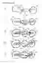 Fig. 06 - Direct dental bridge