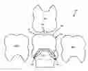 Fig. 01 - Dental prosthesis manufacturing aids